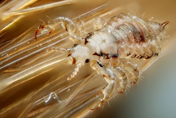 Male-lice-on-hair-strands