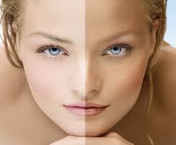 Reasons of Skin darkening during winters and its cure