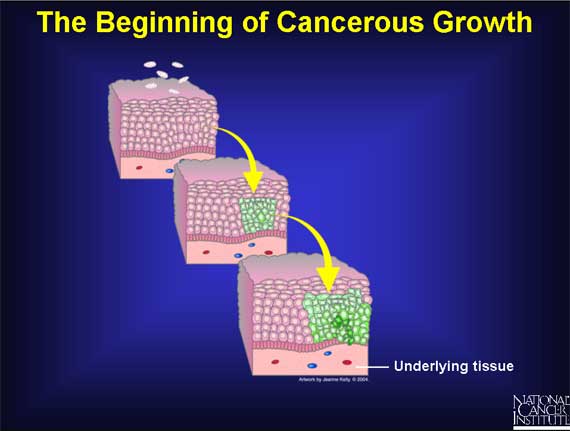 development of cancer cells