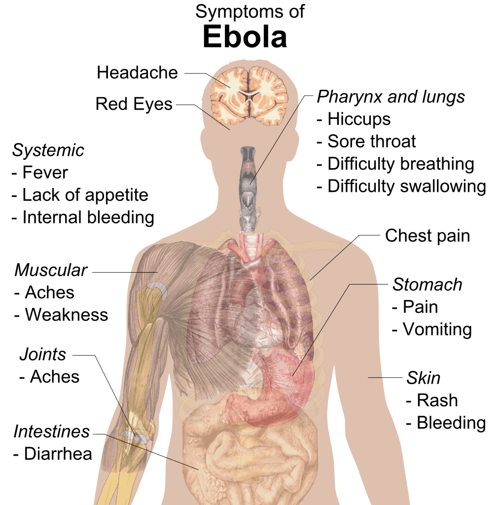 symptoms of ebola