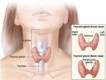 Hypothyroidism- thyroid problems