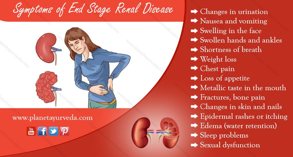 What Are The Symptoms Of End Stage Kidney Disease