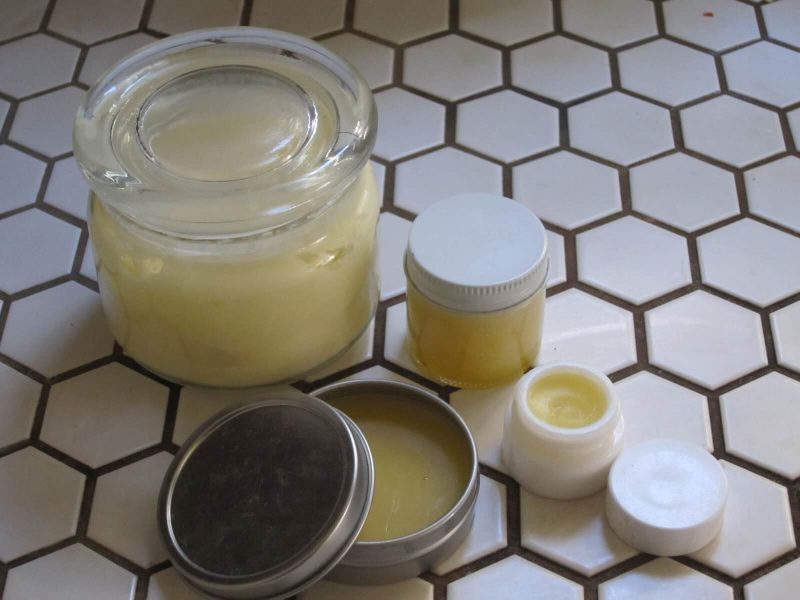 homemade moisturizer for acne