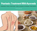 Psoriasis _ Treating With Ayurveda