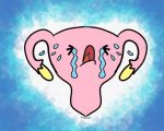 endometriosis-1