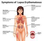 lupus-SLE-symptoms