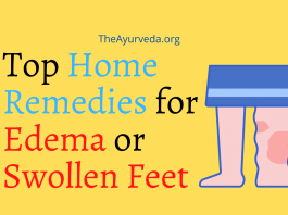home remedies for edema