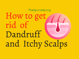 get rid of dandruff
