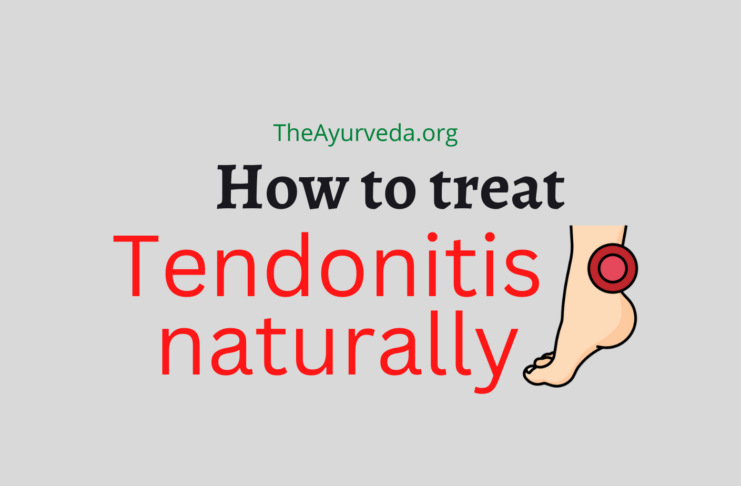 treat tendonitis naturally