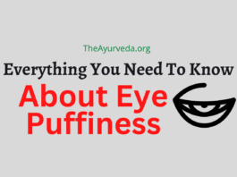 eye puffiness remedies